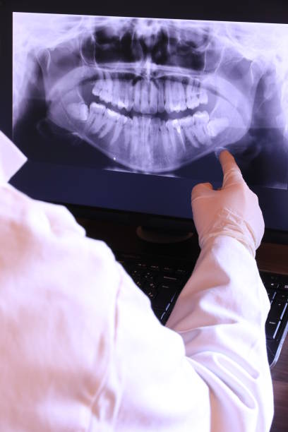 Best Emergency Tooth Extraction in Lusby, MD