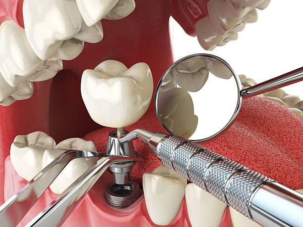  Lusby, MD Emergency Dentist Pros